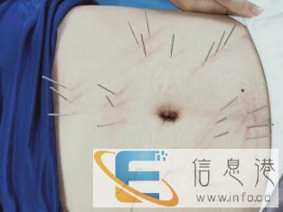 学习针灸推拿去哪里好 松原哪里有针灸推拿培训考证 学习针灸推拿去哪里好 松原哪里有针灸推拿培训考证